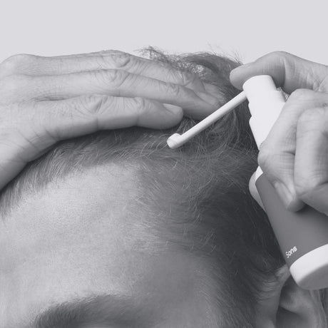 Sons Hair Regrowth Spray for Mens Hair Loss Minoxidil Spray 60ml - Exp: 2025